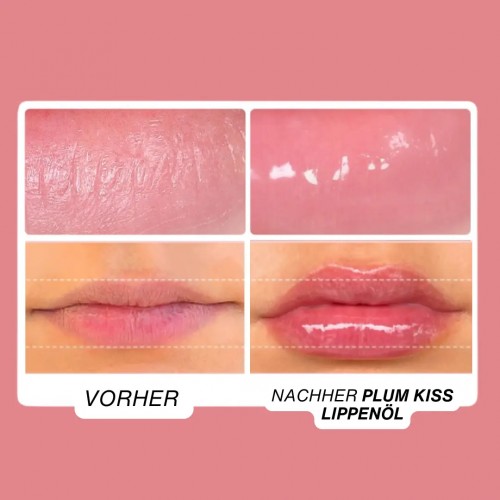 Set zur Lippenvergrößerung und Faltenbekämpfung